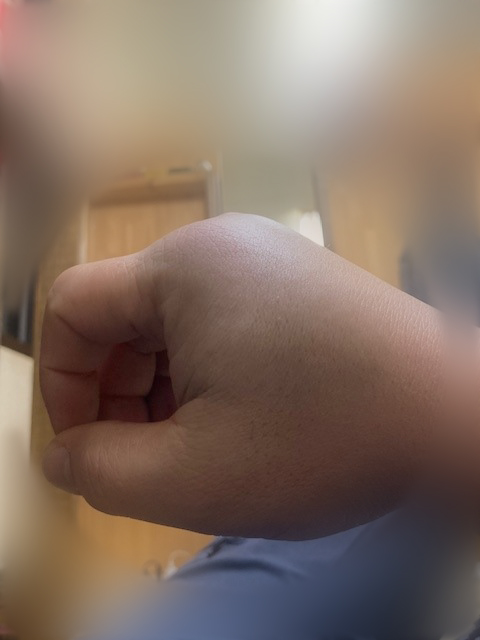 壁紙 クロス 傷 破れ DIY 補修